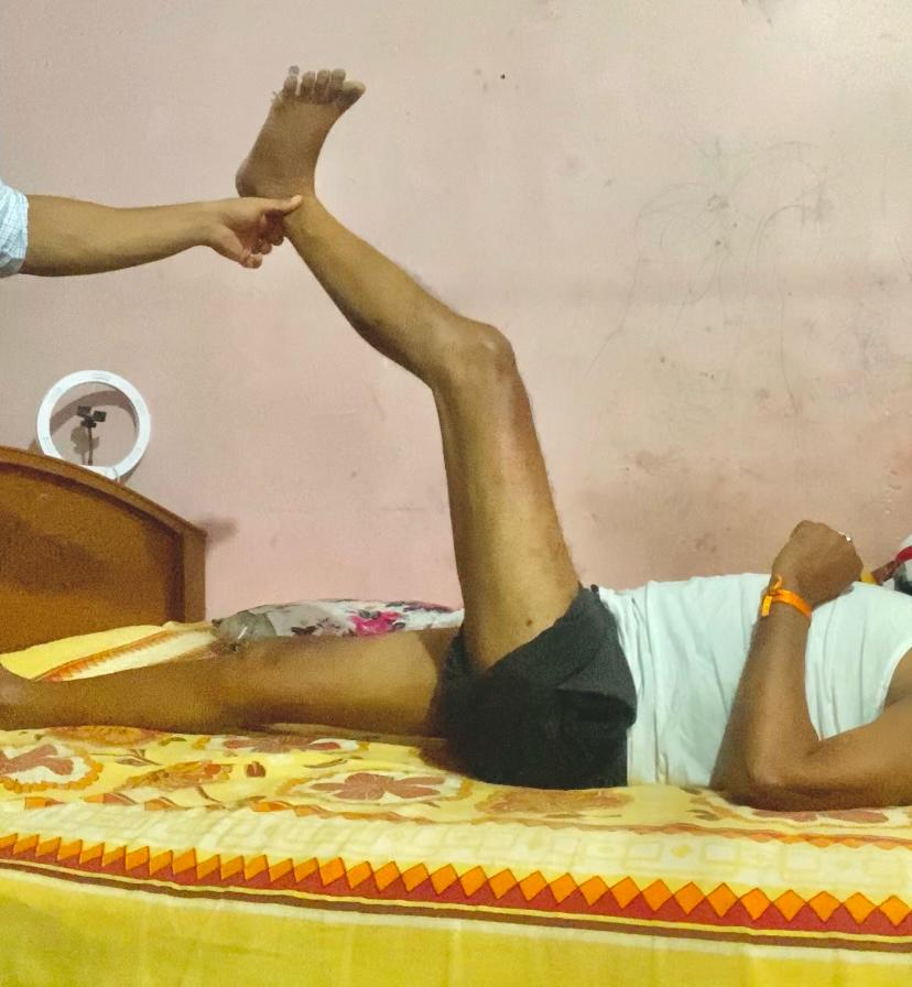 After - Stoke Patient Day 1 Results, Hamstring Tighness (Affecting Balance and gait ) 
